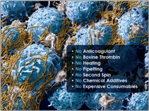 Cellular view of platelet rich fibrin