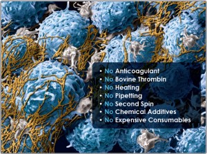 Cellular view of platelet rich fibrin